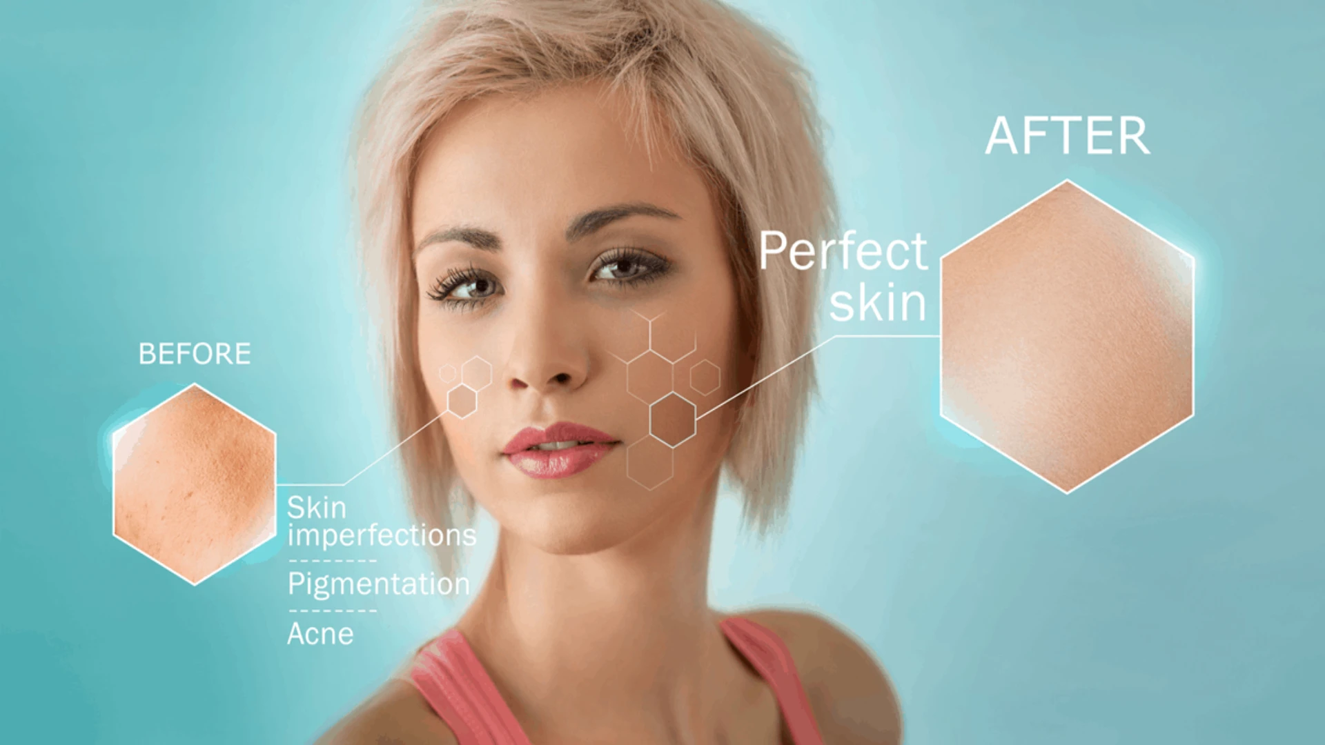 Revive your youthful radiance with the powerful 10 benefits of laser skin rejuvenation.