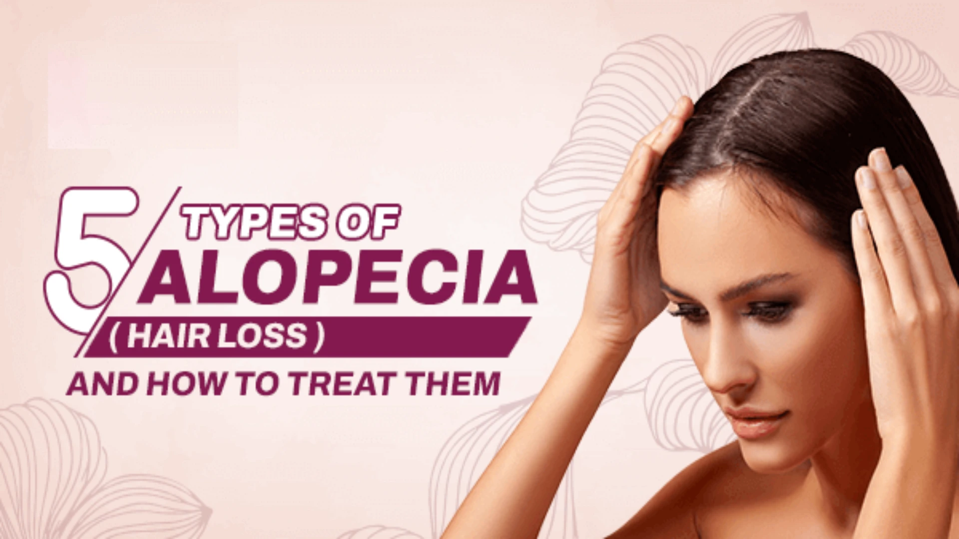 Discover the 5 common types of alopecia, their causes, and hair loss solutions.