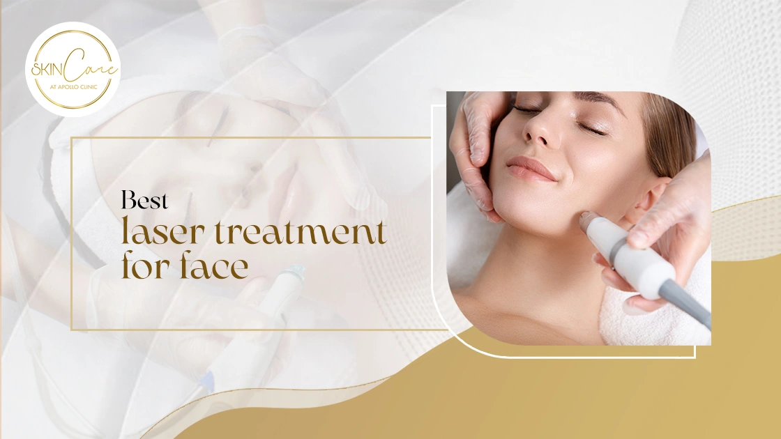 Best Laser Treatment for Face