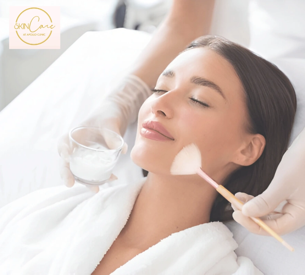 chemical peel cost in guwahati