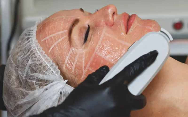 Explore the key pros and cons of HIFU facial treatments.